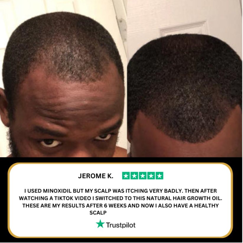 PURE Hair Growth Oil
